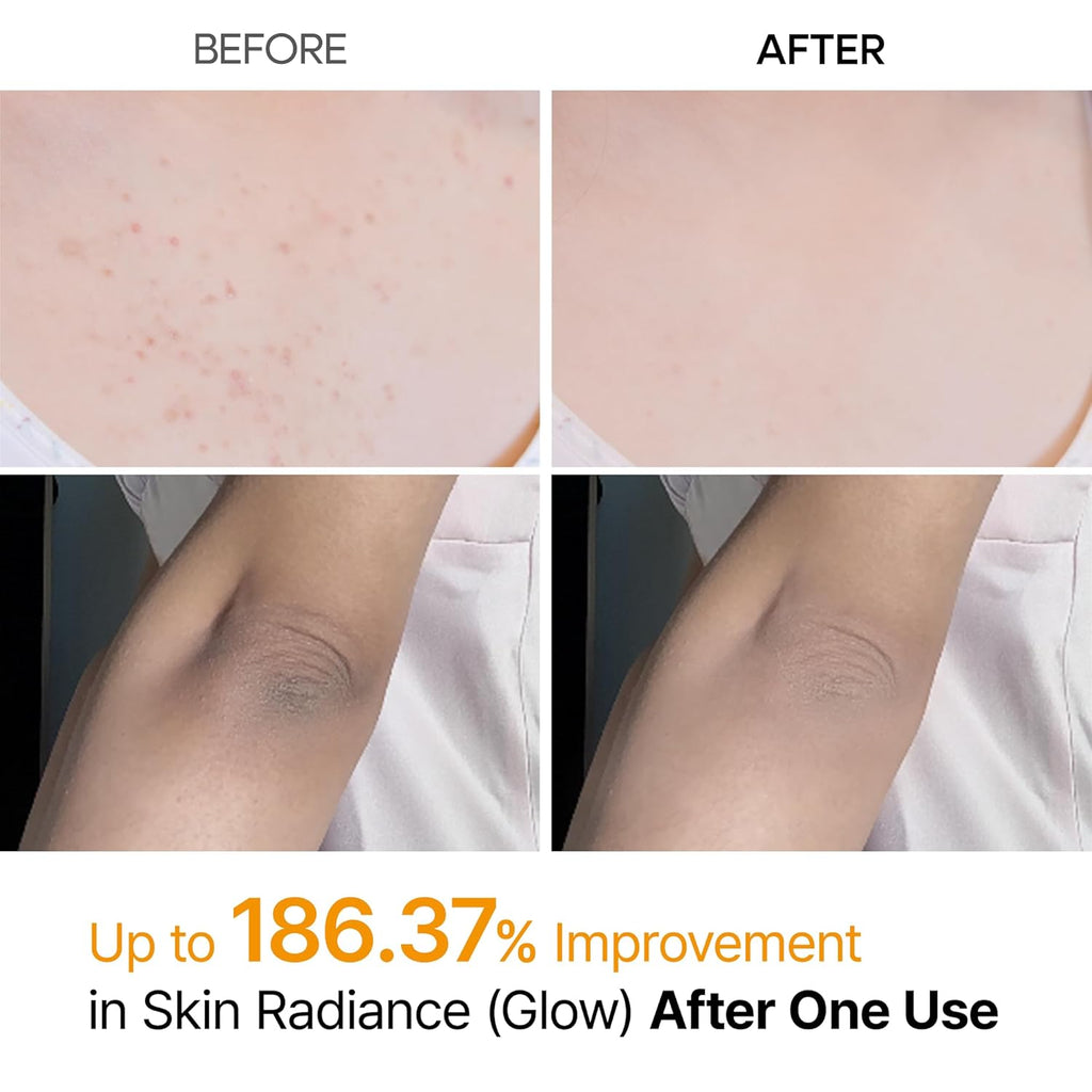 Body Exfoliating Spray with Kojic Acid and Turmeric