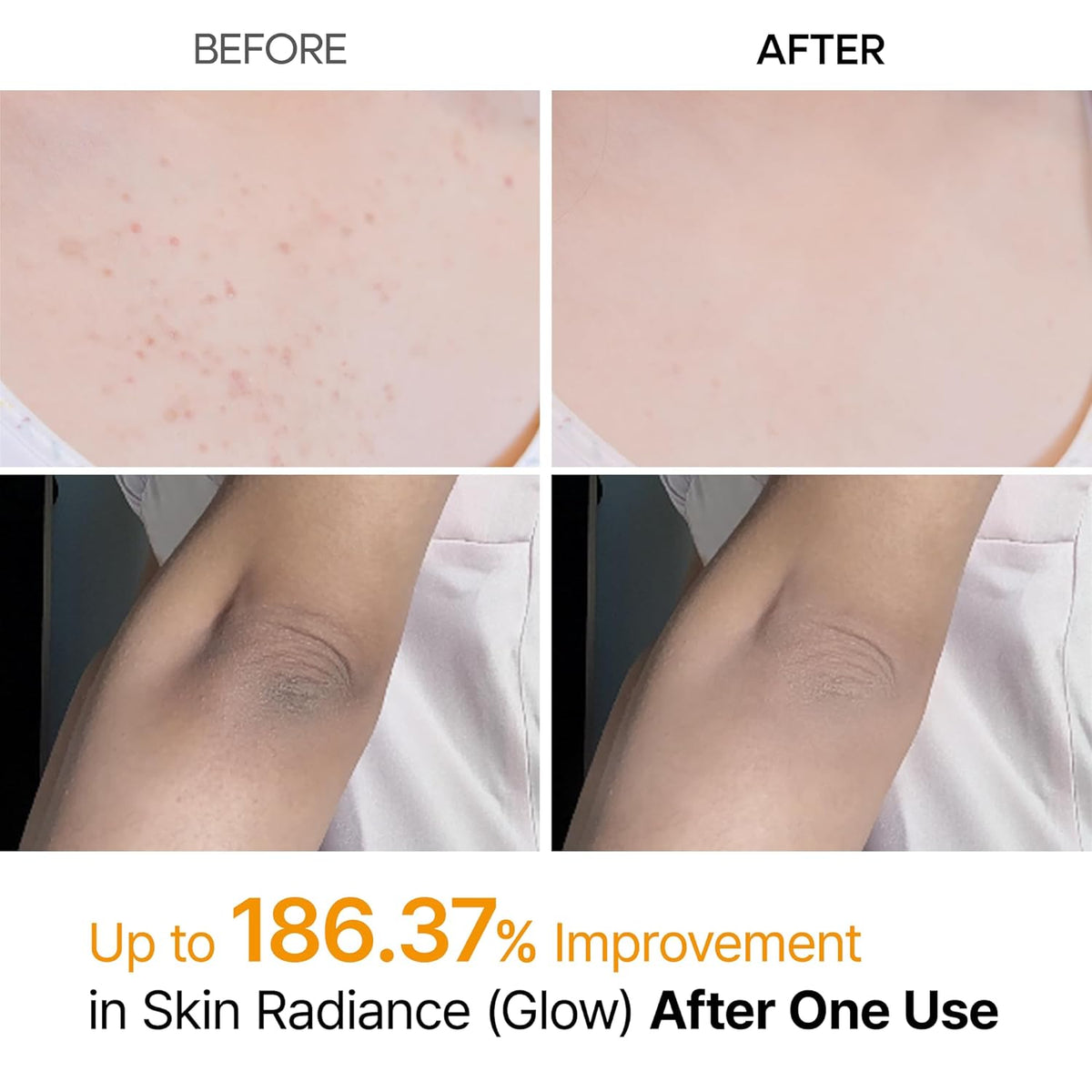 Body Exfoliating Spray with Kojic Acid and Turmeric