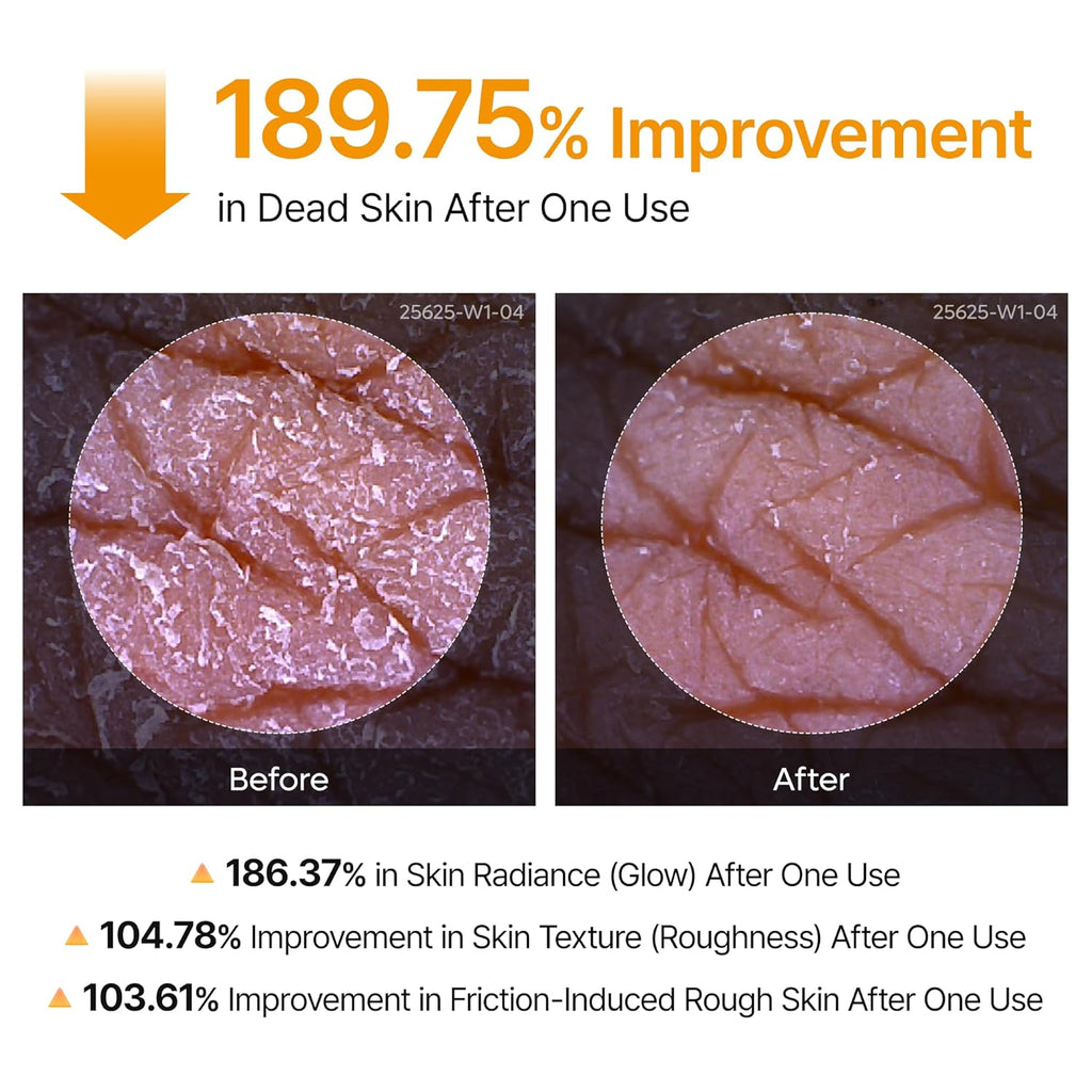 Body Exfoliating Spray with Kojic Acid and Turmeric